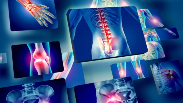 Read more about the article Understanding the Chronic Musculoskeletal Pain Problem