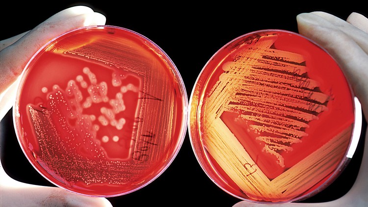 Read more about the article Microbiology: Characterization & Identification