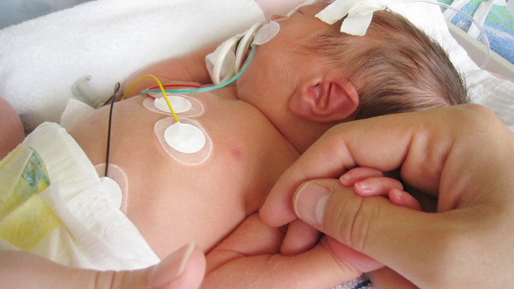 Read more about the article Occupational Therapy and Family Centered Care in the NICU