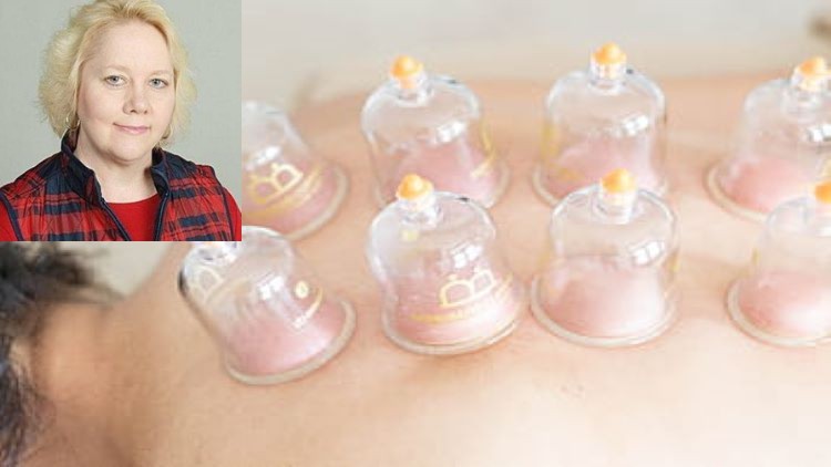 Read more about the article Cupping Therapy Business Guide: From Start-Up to Success