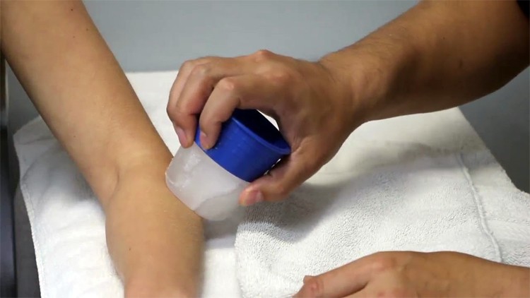 Read more about the article Cryotherapy ICE Cupping Massage Course