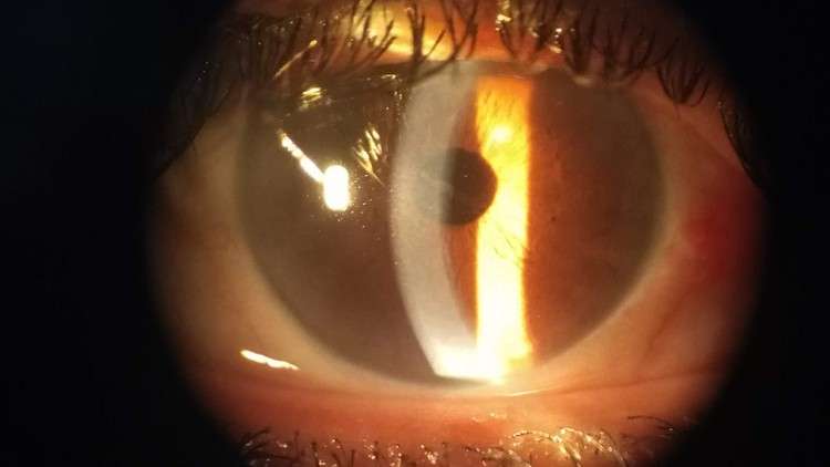 Read more about the article Clinical ophthalmology, a conceptual approach .