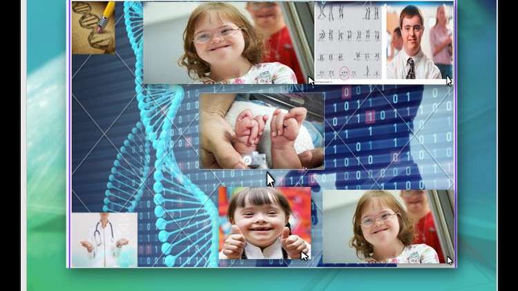 Read more about the article medical genetics learn abnormal human variations