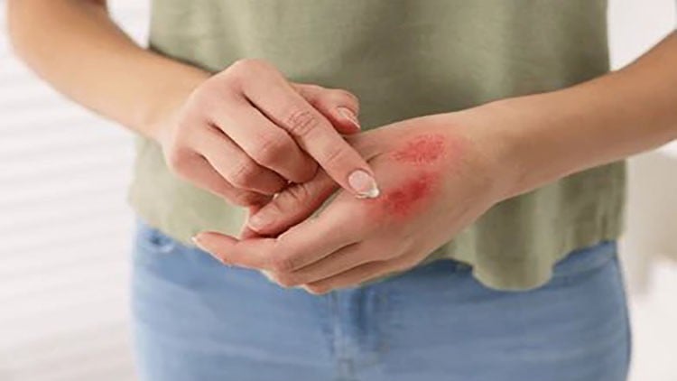 Beyond the Burn: Comprehensive Burn Care Strategies